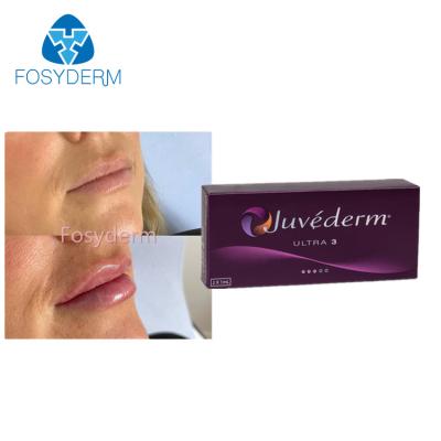 中国 Juvederm Ultra3の唇の強化のHyaluronic酸の皮膚注入口2x1.0ml 販売のため