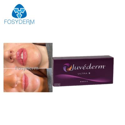 中国 2x1ml唇の強化のJuvedermの皮膚注入口の十字はHyaluronic酸の注入をつないだ 販売のため