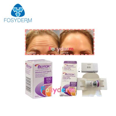 China 100Units Botulinum Anti Wrinkle Toxin Allergan Injection TypeA Botox for sale