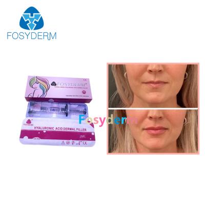 China Línea ácida hialurónica de Derm de la inyección del aumento del labio de los llenadores cutáneos del labio de Fosyderm 2ml en venta