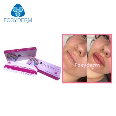 China Durability Dermal Lip Fillers High Safety 2ml With Good Shape Retention à venda