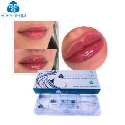 China Fosyderm Hyaluronic Acid Gel Anti Facial Wrinkles Dermal Fillers Injection for sale