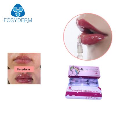 中国 Fosyderm Cross Linked Hyaluronic Acid Dermal Filler For Skin Rejuvenation 販売のため