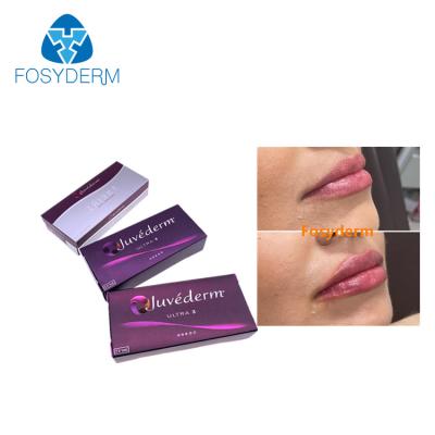 China Anti Wrinkles Juvederm Dermal Lip Fillers 2*1ml Hyaluronic Acid Injection for sale