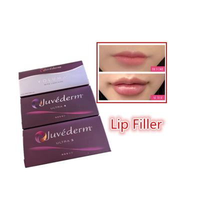 China 2 Ml Acid Hyaluronic Cross Linked Dermal Filler Juvederm Lip Filler Injections for sale