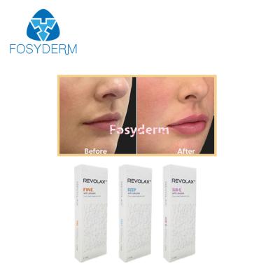 China 1.1ml Dermal Lip Fillers Revolax Fine Deep Sub-Q For Anti Wrinkles Hyaluronic Acid Injection for sale