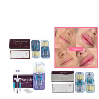 China Juvederm Dermal Lip Fillers 2*1ml Hyaluronic Acid Cross Linked Injection for sale