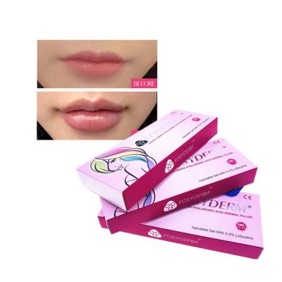 中国 HA Injectable Dermal Filler Fullness Lip Filler Injections Anti Aging 販売のため