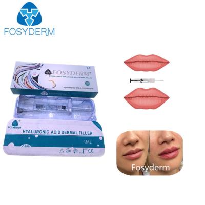 China Hyaluronic Acid Injectable Dermal Filler 1ml 2ml For Lips Augmentation for sale