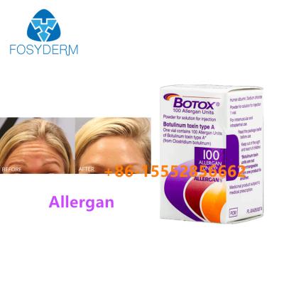 China 100 unidades de Toxina Botulínica Alérgico Elimina arrugas faciales Inyección Botox Tipo A en venta