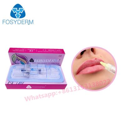 China Fosyderm Hyaluronic Acid Non Invasive Lip Filler Cross Linked HA Fillers for sale