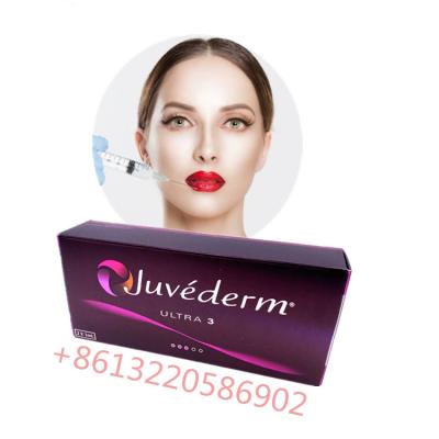 Chine Hyaluronique acide de lèvre lié par croix de remplisseur d'injections cutanées de Juvederm Ultra3 à vendre