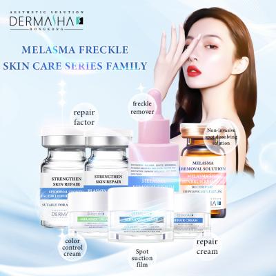 China 5ml Melasma Treatment Cream To Fade Hyperpigmentation For Spots Removal for sale