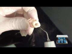 Dental Ultrasonic Cordless Activator