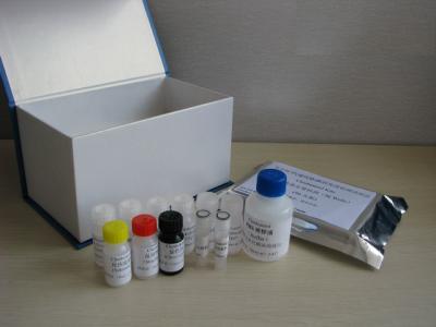 China Rat NADPH Oxidase 1(NOX1) ELISA Kit for sale
