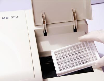 China Resultado de la prueba externo de los analizadores 1000000 de Elisa Reader Machine Medical Lab del ordenador MB-530 en venta