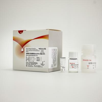 Китай CE Assay набора теста протеина c плазмы сыворотки реактивный in vitro продается