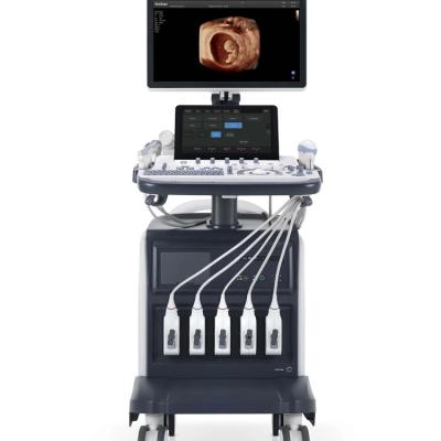 Chine Logiciel d'onde entretenue Tdi de machine d'ultrason de Sonoscape S60 Ecografo Sonoscape pour libre à vendre