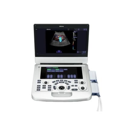 Chine Sonde linéaire de l'équipement 17MHz d'obstétrique et gynécologie de machine d'ultrason de couleur à vendre