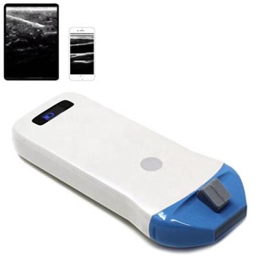Chine Sonde linéaire sans fil portative d'ultrason de Sonostar BW PICC pour le guide de biopsie à vendre