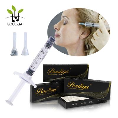 China Natural Treatment Hyaluronic Dermal Filler Non Surgery Forehead Wrinkle Glabellar Lines for sale