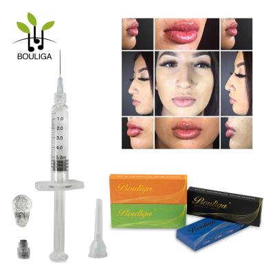 China Injectables Biodegradable Hyaluronic Acid Breast Filler 20mg/Ml for sale