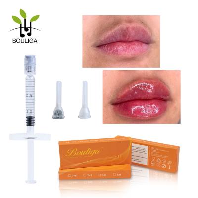 China Cross linked 1 Ml Hyaluronic Acid Lips Injectable Long Lasting Dermal Filler for sale