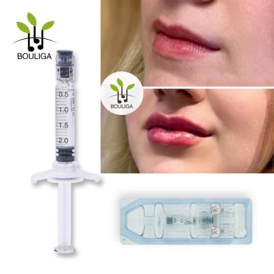 China 2ml Lips Dermal Filler Monophasic Cross Linked Hyaluronic Acid Filler For Lip for sale