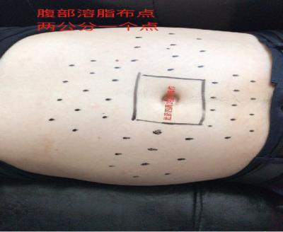 China PPC de queimadura gordo das injeções de Lipo do emagrecimento do hospital para a dissolução gorda à venda