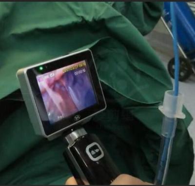 China Intubação do uso de ICU EMS laringoscópio video da única com definição de 1280 x 720 câmeras à venda