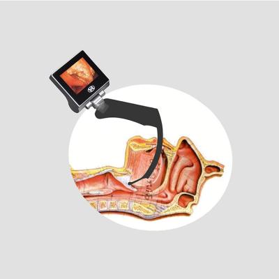 China ICU NICU CCU Anti Fog Lens Adult Laryngoscope For Neonates for sale
