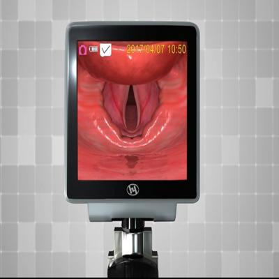 China O vídeo portátil do LCD de 3 polegadas ajudou ao laringoscópio 3400 miliampères à venda