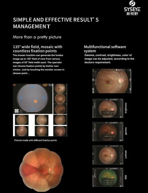 Automated Fundus Camera with Images and Multimodal Imaging Options for Small Pupil Imaging and Easy Operation