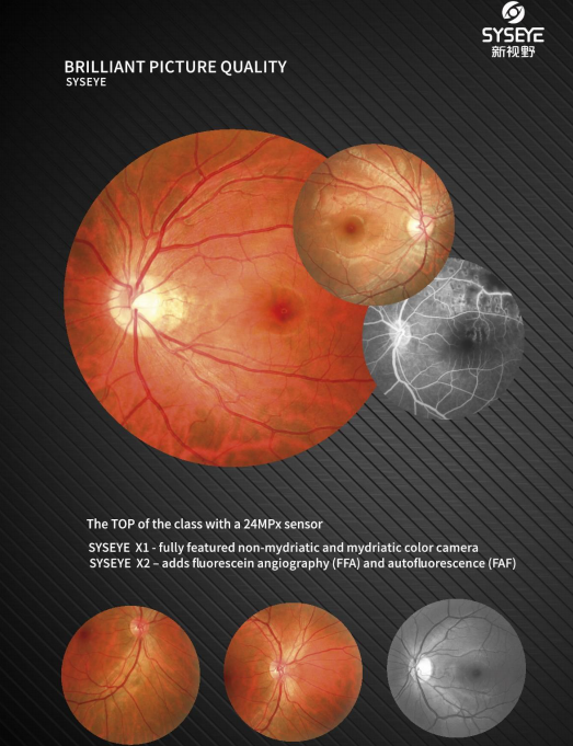 Automated Fundus Camera with Images and Multimodal Imaging Options for Small Pupil Imaging and Easy Operation