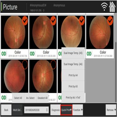 Китай Ручная томография сцепления офтальмологии камеры Fundus цифров продается