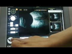 팬 스캔 B스캔 기계 10MHz 관측 망막 디태치먼트