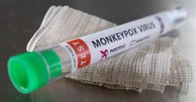 China Equipo en tiempo real de la polimerización en cadena del virus de Monkeypox en venta