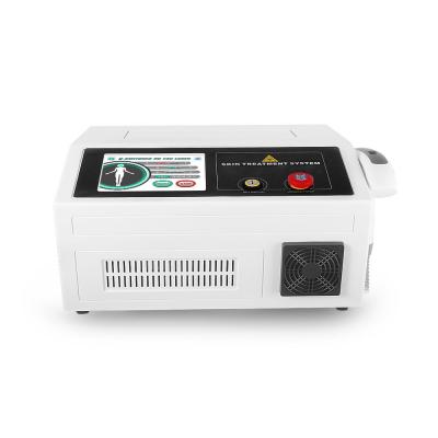 China O pigmento Q do ISO 532nm comutou a máquina do laser do ND Yag à venda