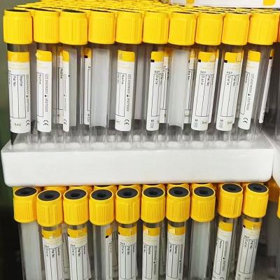 China Yellow Printed Blood Collection Tube Factory FSC Certified à venda