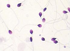 China BRED-015 Sperm Morphology Staining Kit Diff Quik Rapid Staining Method for sale