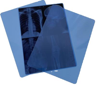 China 195 Microns 11*14 Inch Medical Thermal Film Fuji 3500 Blue Thermal Film X Ray for sale