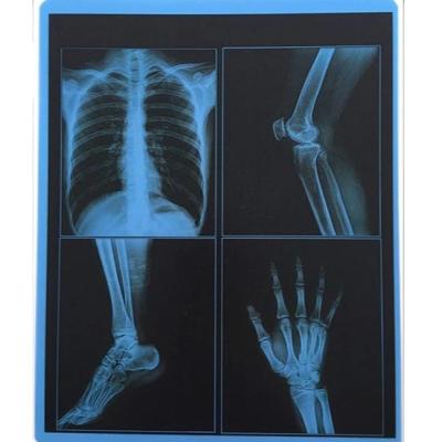 China 25cm X 30cm Blue Transparency PET Thermal Film Medical Dry Imaging Film For Hospital for sale