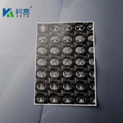 China 180um A3 White Inkjet Medical X Ray Film Canon Epson Inkjet Printer Film en venta