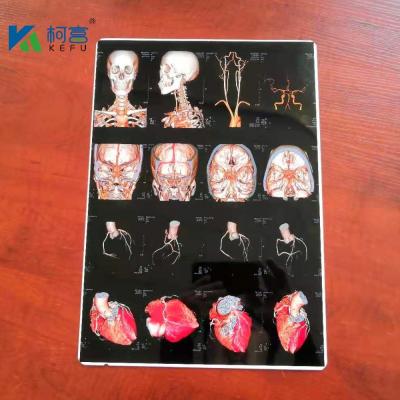 China Eco Friendly PET Based Medical Dry Film White Inkjet X Ray Film 150 Microns for sale