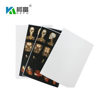 Chine Blue White Base Medical X Ray Film 35x43CM 10x12 Inch X Ray Dry Film For Fuji Printer à vendre