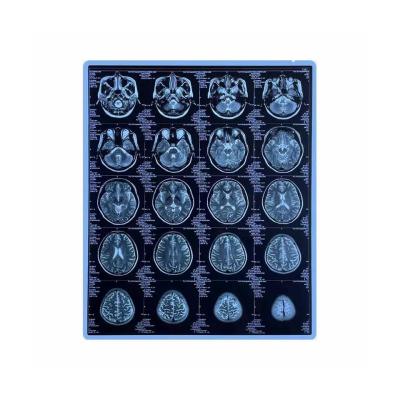China CE Printable Blue Medical X Ray Film 11x14 Inch Pet Inkjet Film for sale