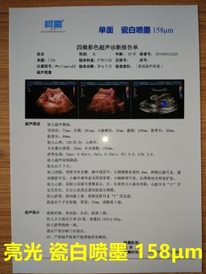 중국 125 Microns White Base Opaque Inkjet Medical Film Three Dimensional CT Scan Film 판매용