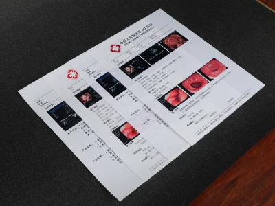 중국 엡손 프린터를 위한 A4 A3 13X17 애완 X- 선 영화 하얀 잉크젯 의학 건조박막잔류 판매용
