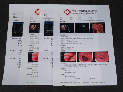 중국 애완 기반을 둔 의학 건조박막잔류 판매용