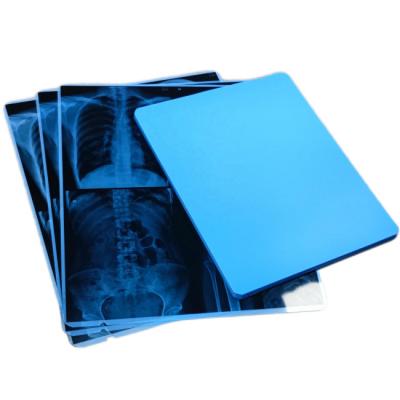 Chine Original Fuji Printer 210microns Medical X Ray Film For Thermal Drypix 3500 Printer à vendre